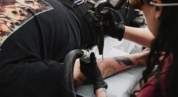 Laser Tattoo Removal Specialist Vancouver BC