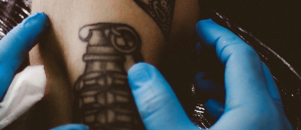 Where to Get a Tattoo Lasered Off - Vancouver or Toronto